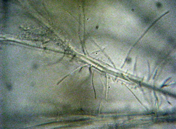 Microscopia salata